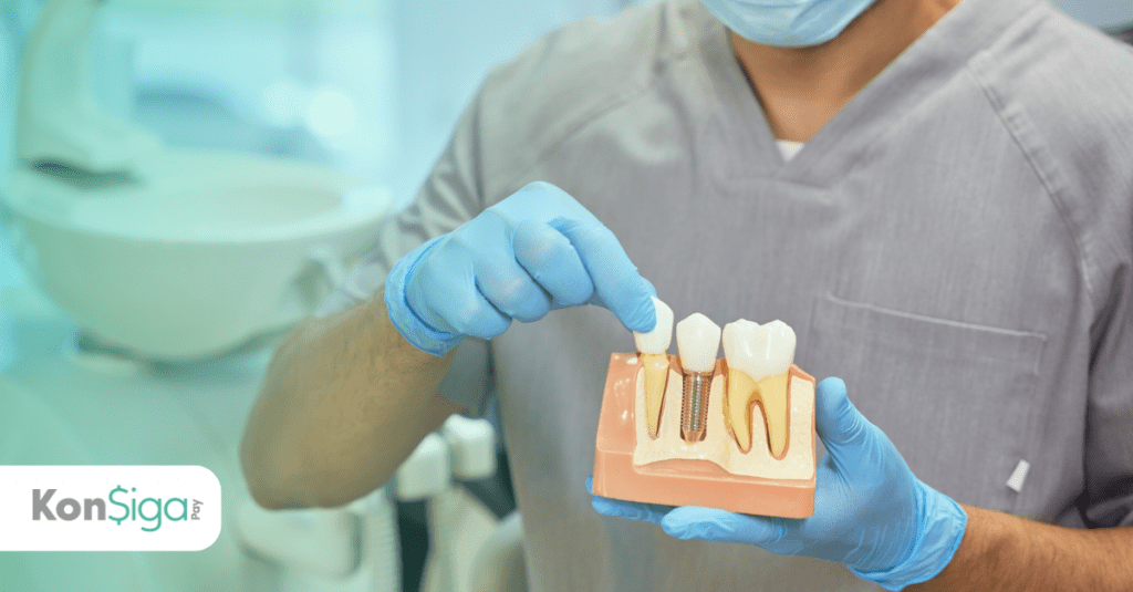 Financiamento de Implante Dentário